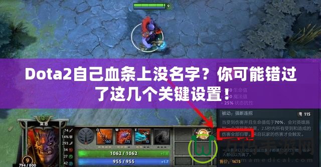 Dota2自己血條上沒名字？你可能錯(cuò)過了這幾個(gè)關(guān)鍵設(shè)置！